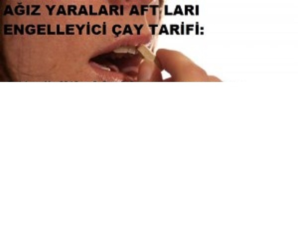 Ağız yarası(aft)giderici bitkisel gargara