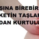 BÖBREK TAŞINI ERİTEN İÇECEK