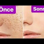 Gözenek sıkılaştırıcı maske tarifi