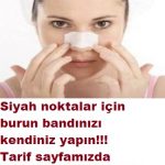 SİYAH NOKTALAR İÇİN BURUN BANDINIZI EVDE KENDİNİZ YAPIN VİDEOLU