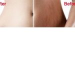 Hepinizin evinde bulunan bu kremle çatlaklarınızdan kurtulabilirsiniz