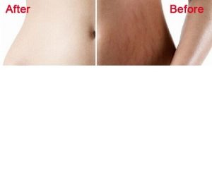 Read more about the article Hepinizin evinde bulunan bu kremle çatlaklarınızdan kurtulabilirsiniz