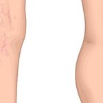 Varis için bu karışımı kullanın