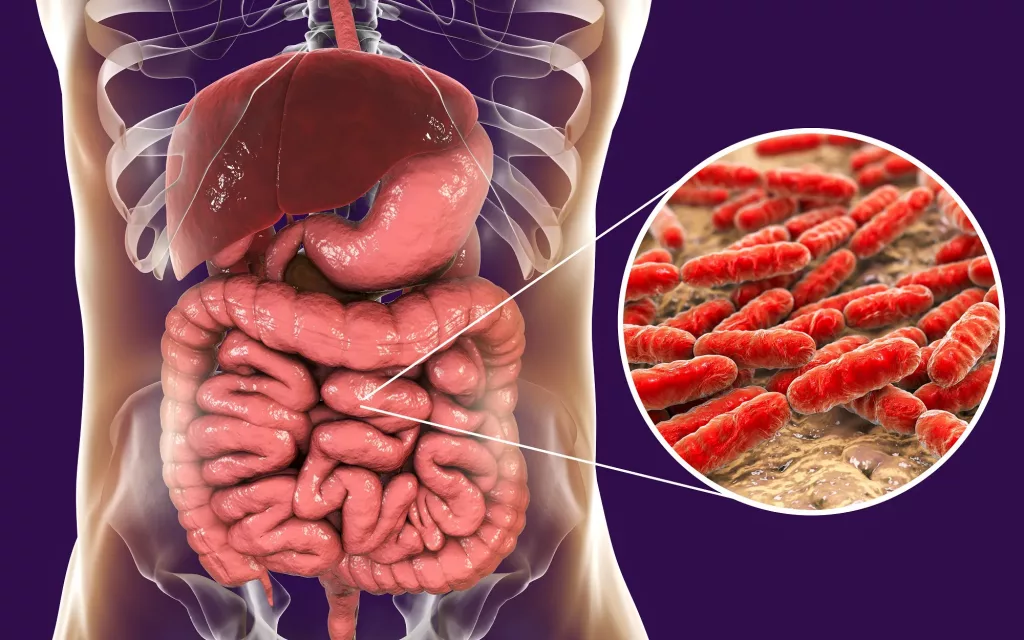 Bağırsak gribi nedir tedavisi nasıldır