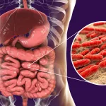 Bağırsak gribi nedir tedavisi nasıldır