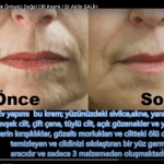 Aidin Salih kırışıklık önleyici doğal krem tarifi