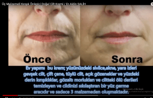Read more about the article Aidin Salih kırışıklık önleyici doğal krem tarifi