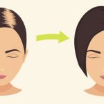 Saçınıza karbonat ekleyin nedenini duyunca şaşıracaksınız