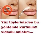 Yüz tüyleri nasıl yok edilir