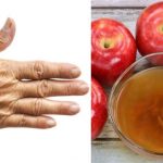 Kahverengi lekeleri geçiren tek doğal kür