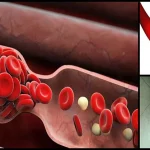 Pıhtılaşmayı önleyen doğal kan sulandırıcılar nelerdir