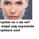 Kırışıklık gideren en etkili doğal tarif