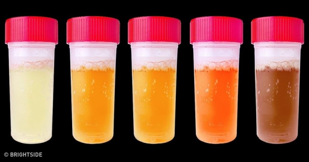 Hangi idrar rengi neyin habercisi