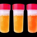 Hangi idrar rengi neyin habercisi