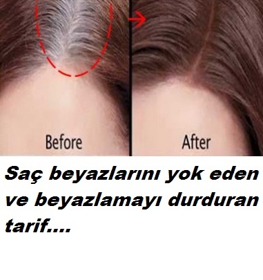 Bu yöntemle saç beyazlamasına son