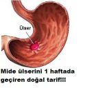Mide ülserini çok kısa sürede geçiren kür