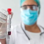 Maymun çiçeği hakkında bilmeniz gereken önemli bilgi