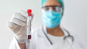 Read more about the article Maymun çiçeği hakkında bilmeniz gereken önemli bilgi