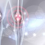 Eklem ağrısı varsa bu yiyecekleri sakın yemeyin