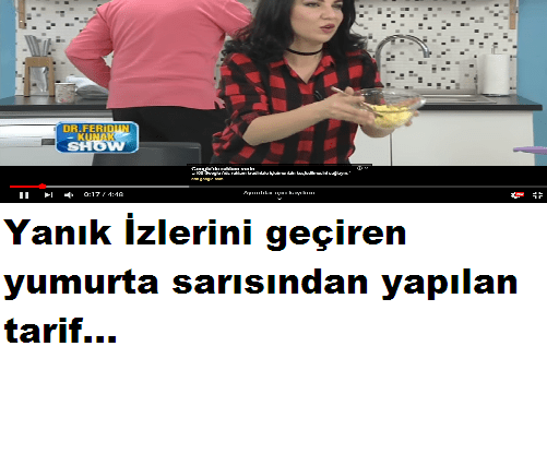 Yanık izini tamamen geçiren tarif