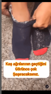 Read more about the article Kas ağrılarını alüminyum folyo ile geçirebilirsiniz