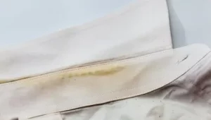 Read more about the article Beyaz Çamaşırlardaki Sarılıktan Kurtaran Yöntem